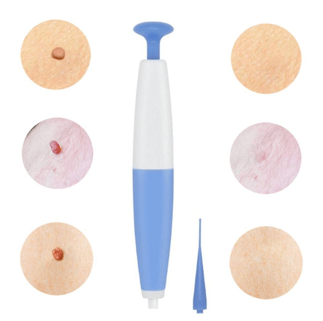 PureSkin Pro Enlèveur de Polypes Cutanés – Solution Maison Sans Douleur pour Peau Parfaite
