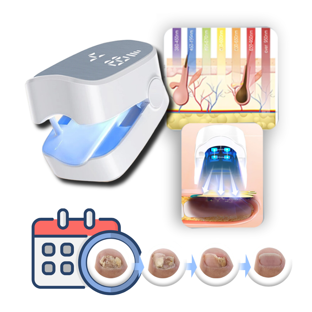 Smertfri Laserbehandling for Neglesopp